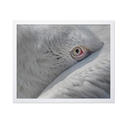 Eye