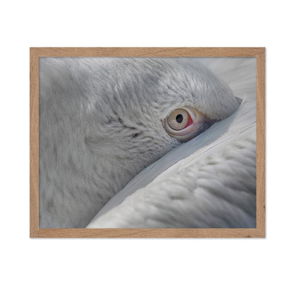 Eye