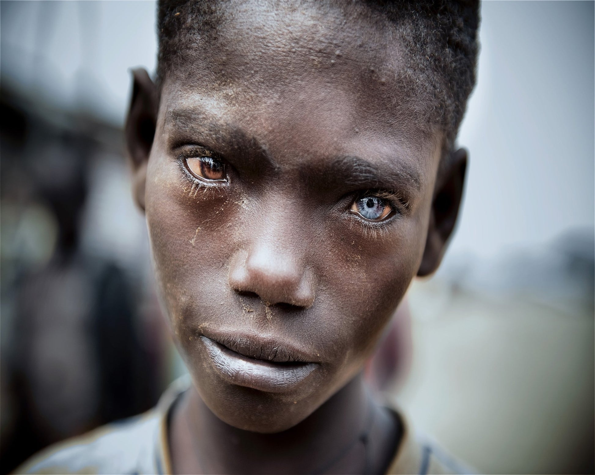 Striking Dual Eye Portrait