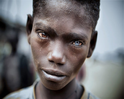 Striking Dual Eye Portrait