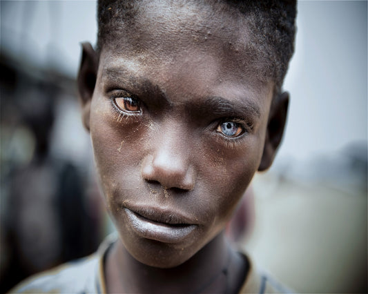 Striking Dual Eye Portrait