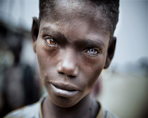 Striking Dual Eye Portrait