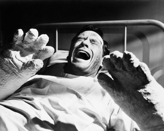 The Hands of Orlac 1960 Mel Ferrer