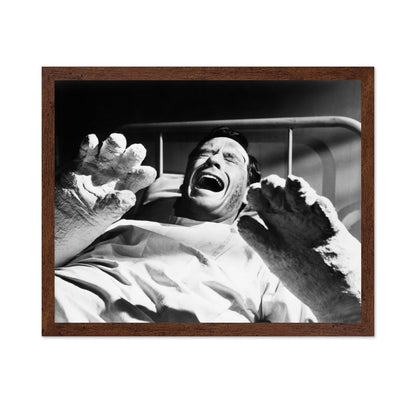 The Hands of Orlac 1960 Mel Ferrer