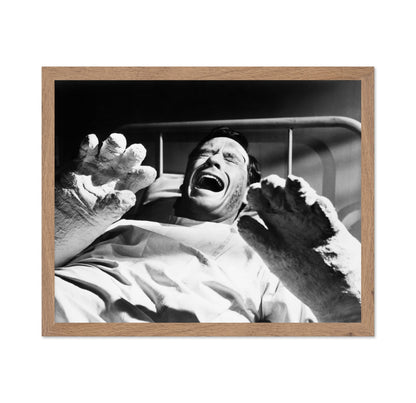 The Hands of Orlac 1960 Mel Ferrer