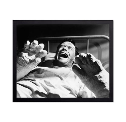 The Hands of Orlac 1960 Mel Ferrer